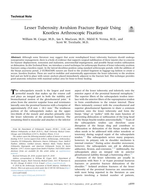 PDF Lesser Tuberosity Avulsion Fracture Repair Using Knotless Arthroscopic Fixation