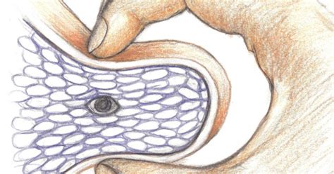 Myofascial Trigger Point Therapy Pelvic Physiotherapy