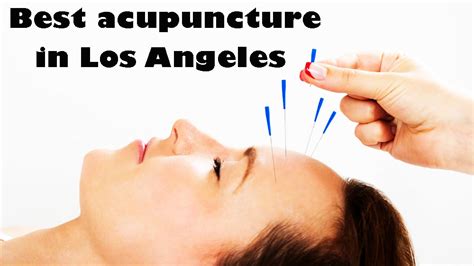 13 Best Acupuncture In Los Angeles Phone Number And Address