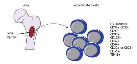 The rai and binet staging systems are often used to predict survival. Identification and targeting leukemia stem cells: The path ...