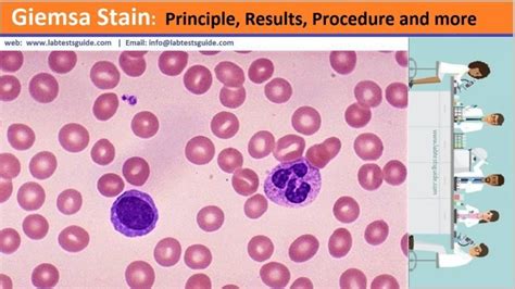 Giemsa Stain Principle Results Procedure And More Lab Tests Guide