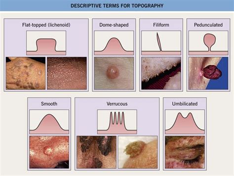 Basic Principles Of Dermatology Clinical Gate