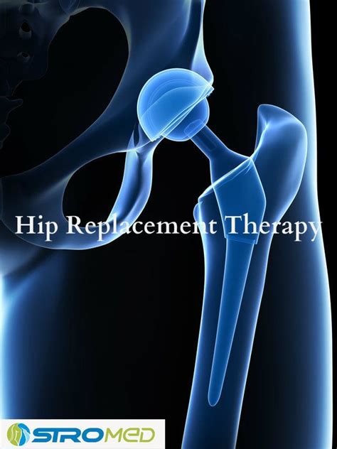 Pin On Hip Replacement Therapy