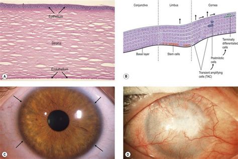 Tissue Engineering For Reconstruction Of The Corneal Epithelium Ento