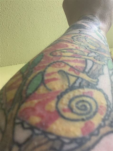 Weird Bumps On My Tattoo Photos