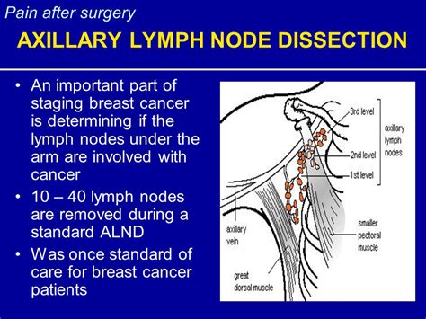 Swollen Lymph Nodes After Taking Antibiotics