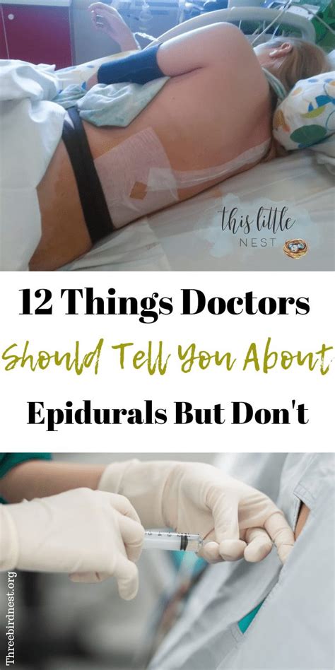 12 things you need to know about epidurals before having one epidural side effects this
