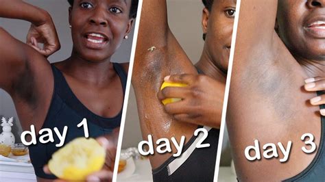 I Tried Lightening Dark Underarms With Turmeric Remedy For 3 Days And