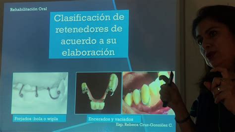 Rehabilitación Oral Protesis Inmediata Fija Y Removible Youtube