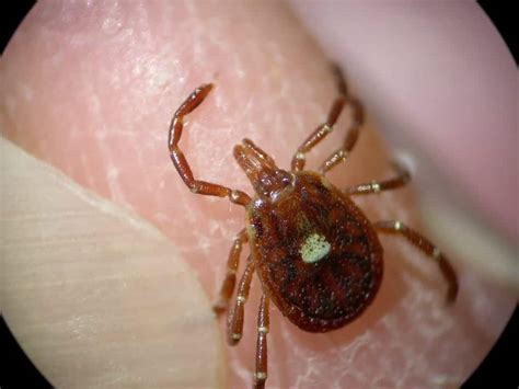Tick Bite Induced Red Meat Allergy Center For Urban Agriculture