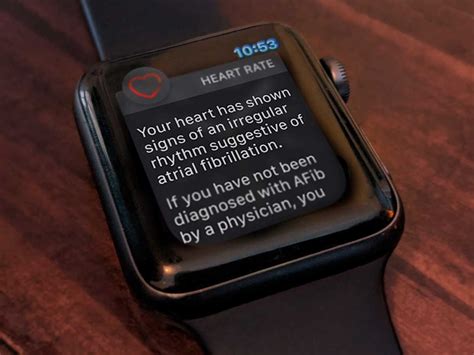 what health conditions can apple watch help you monitor myhealthyapple