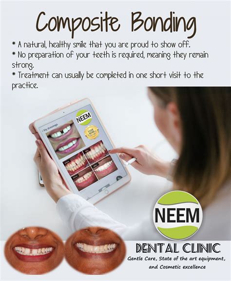 Composite Bonding Blog Neem Dental Clinic