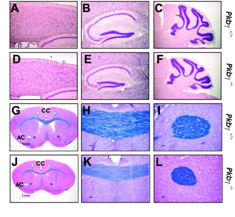 Histology Of Brains From Pkbγ Mutant Mice Representative Sections He
