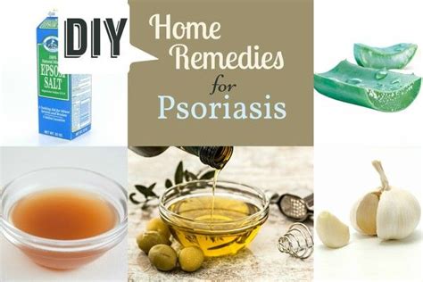 Home Remedies For Psoriasis From The Simplest Treatment To The Other