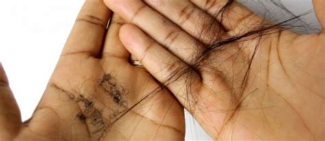 6 Reasons Why Your Hair Is Shedding More Than Normal Women Daily Magazine