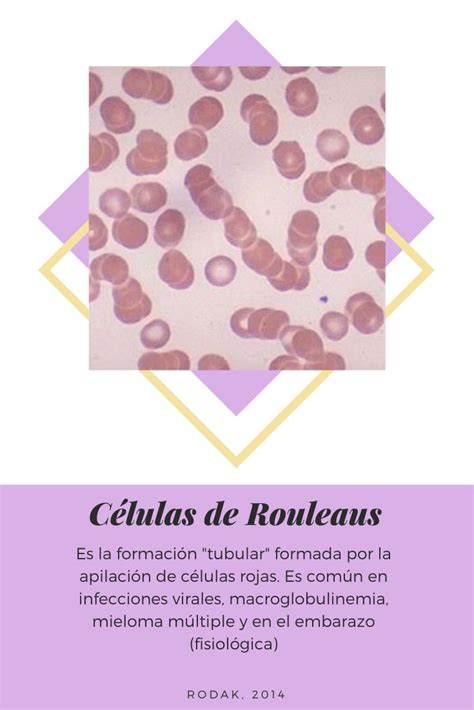 Pin En Hematologia