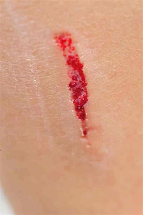 The swelling may also be accompanied by some tenderness instead of the pain gradually reducing it becomes worse over time Signs That a Wound Is Infected - 8 steps