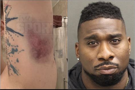ex nfl rb zac stacy s ex gf kristin evans shares photos of her injuries from all the times he