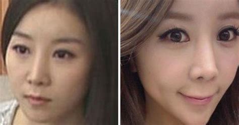 South Korea Plastic Surgery Trend One Tv Presenters Jaw Surgery For