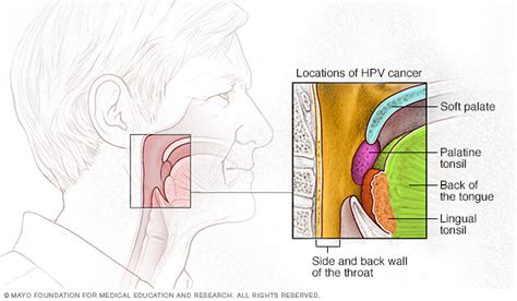Throat Cancer Disease Reference Guide