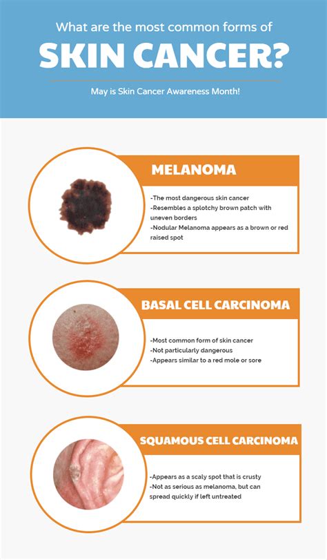 What Are The Most Common Forms Of Skin Cancer