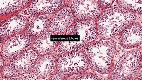 Histology Of Testes Labeled