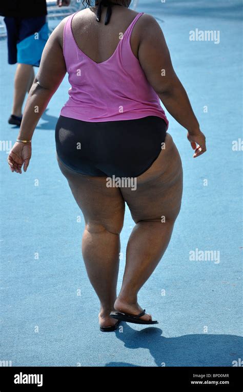 Femme Noire Obèse Avec De Lourdes Cellulite Photo Stock Alamy