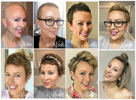 From Bald To Beautiful Tresses The Cancer Thriver S Guide To Hair Regrowth Cancer Be Glammed