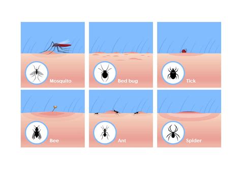 Identifying Bug Bites The Ultimate Guide With Pictures Nextgen Pest Solutions