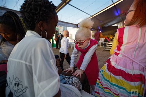 A Groundbreaking Beauty Pageant For Those With Albinism AP Photos