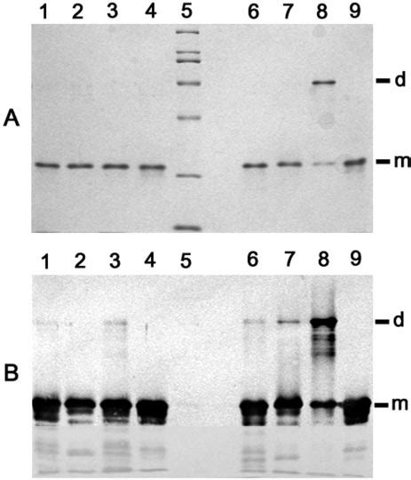 SDS PAGE A And Western Blot B Analyses Of NTPx Proteins A Lane 5