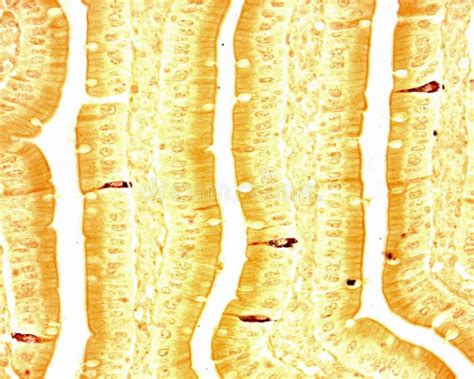 Cellules D Argyrophilic Dans L Pith Lium Intestinal Photo Stock Image Du Villus Intestin