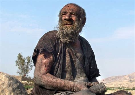 Worlds Dirtiest Man Dies At 94 After First Bath In Over 60 Years