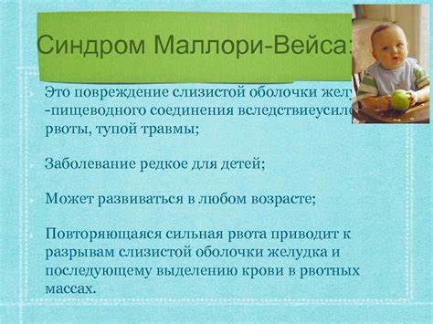 Диета при синдроме мэллори Диета При Синдроме Мэллори Вейса — Похудение Диета Правильное Питание Диета При Синдроме Мэллори Вейса — Похудение Диета Правильное Питание Диета при синдроме мэллори