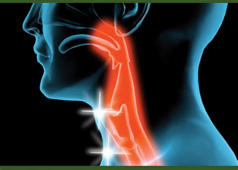 Selalunya, rasa sakit merasakan sensasi yang kuat untuk memerah atau membakar. 'Rasa Macam Makanan Lekat Di Dada'- Awas, Anda Mungkin ...