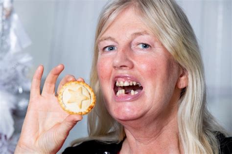 Mum Needs Teeth For Christmas After Swallowing Dentures Eating A Mince