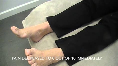 Immediate Pain Relief For Plantar Fasciitis Youtube