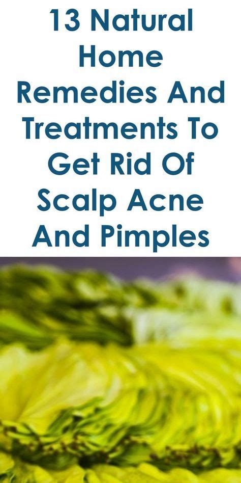 13 Quality Home Remedies To Get Rid Of Scalp Acne And Pimples Scalp