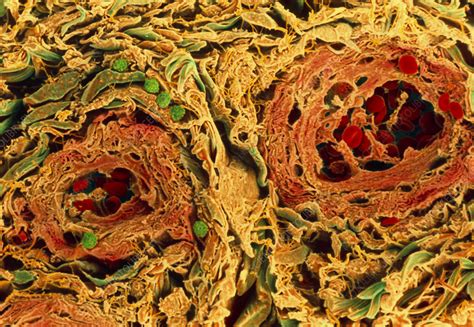 Coloured Sem Of Blood Vessels In The Skin Stock Image P2060140