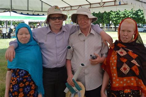 Help Protect Albinos In Tanzania From Skin Cancer Globalgiving