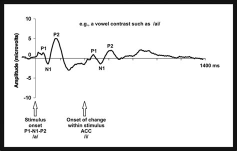 Utilisation Of Cortical Auditory Evoked Potentials In The Paediatric