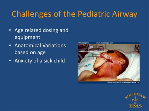Ppt New Orleans Ems Airway Lecture Series Lecture 4 The Pediatric