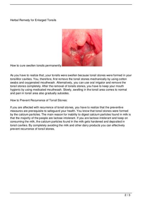 Five Simple Steps To Treat The Swollen Tonsils