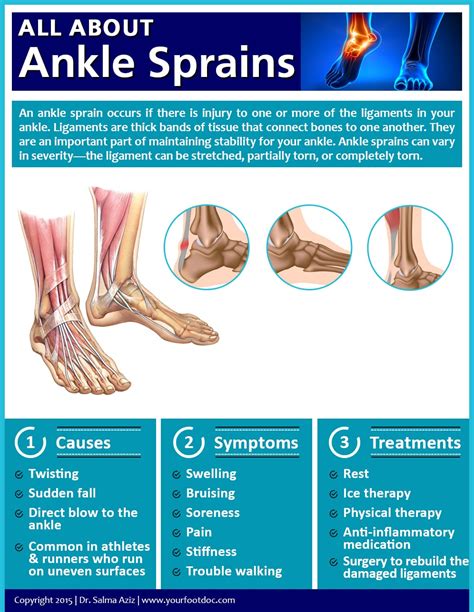 All About Ankle Sprains Infographic Foot And Ankle Specialty Group