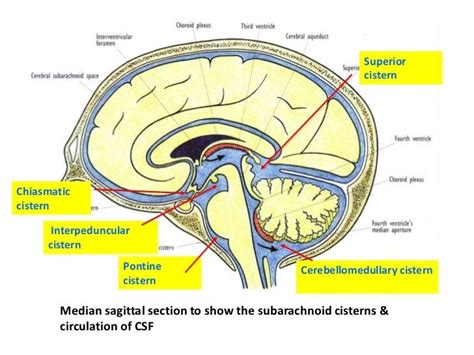 Arachnoid Cisterns Cranial Anatomy Cerebrospinal Fluid Radiology