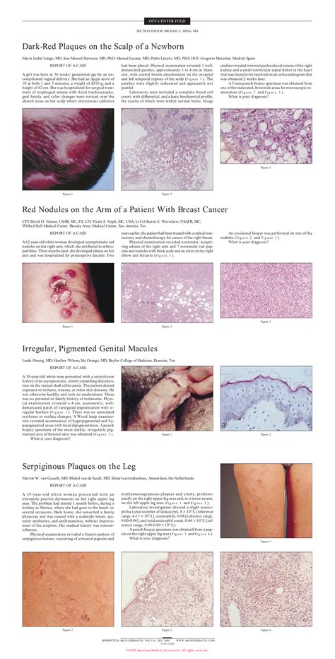 Irregular Pigmented Genital Macules Dermatology Jama Dermatology