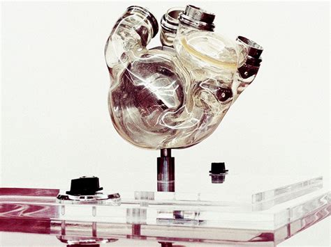 Mechanical Circulatory Support Devices The Artificial Heart And Vads