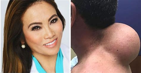 Dr Pimple Popper Is Getting Her Own Tv Show And The Trailer Already Has Us Squirming