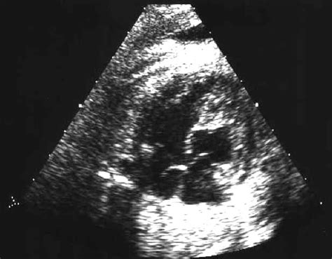 Fetal Echocardiography Homepage