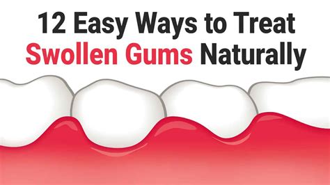 12 Quick Remedies For Treating Swollen Gums